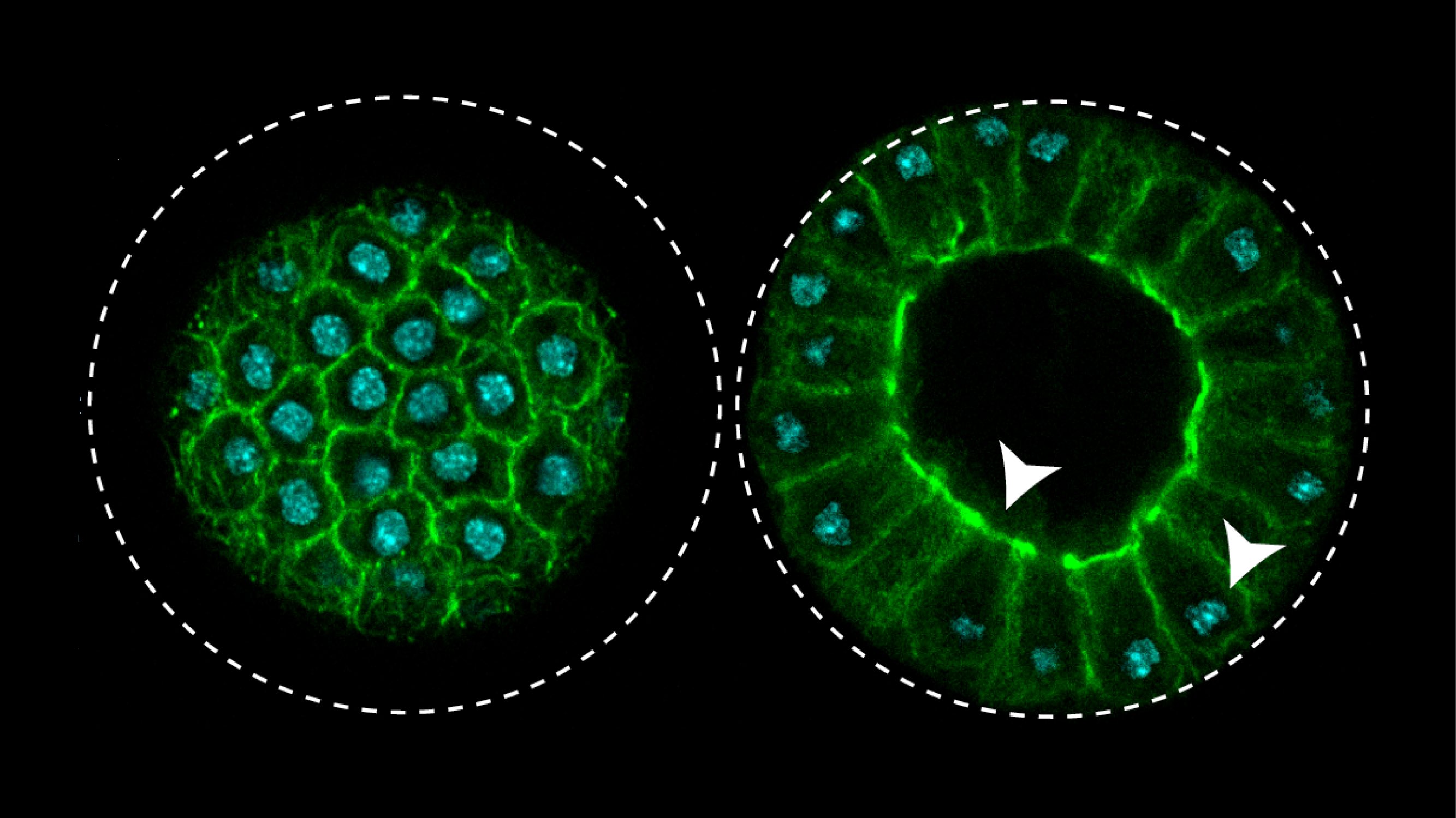 Image of Sphaeroforma arctica just before cellularization, forming a structure reminiscent of an epithelium. In green, the actin network. In blue, the cell nuclei.