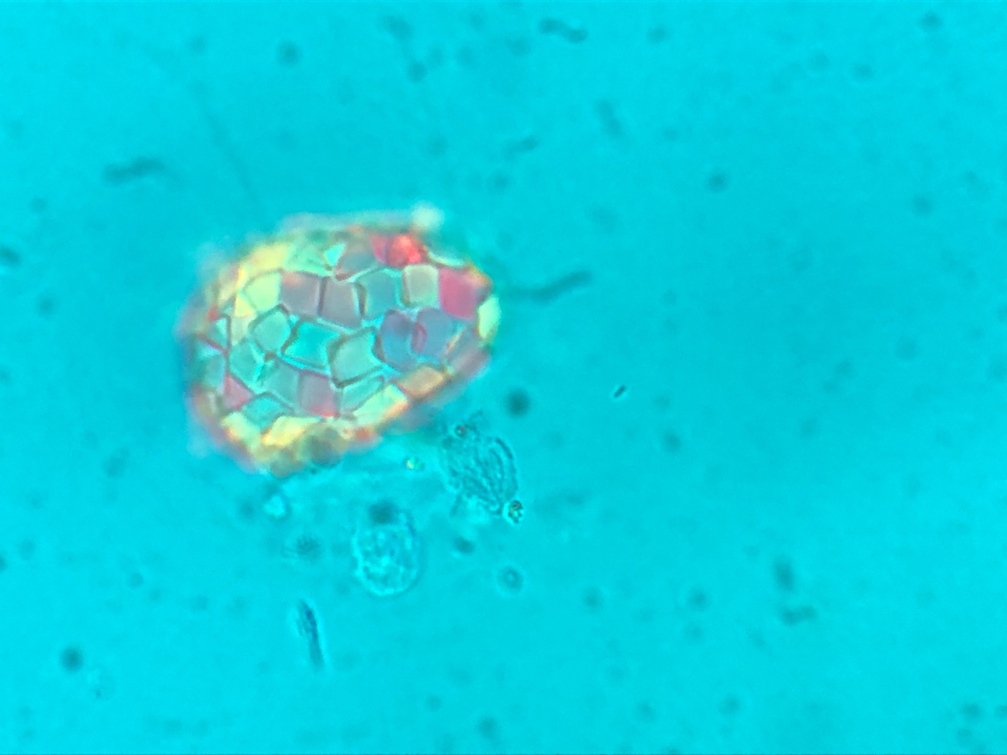 De l'anàlisi inicial van extreure el descobriment d'una nova espècie d'ameba (que de moment han anomenat Astroquadrula).