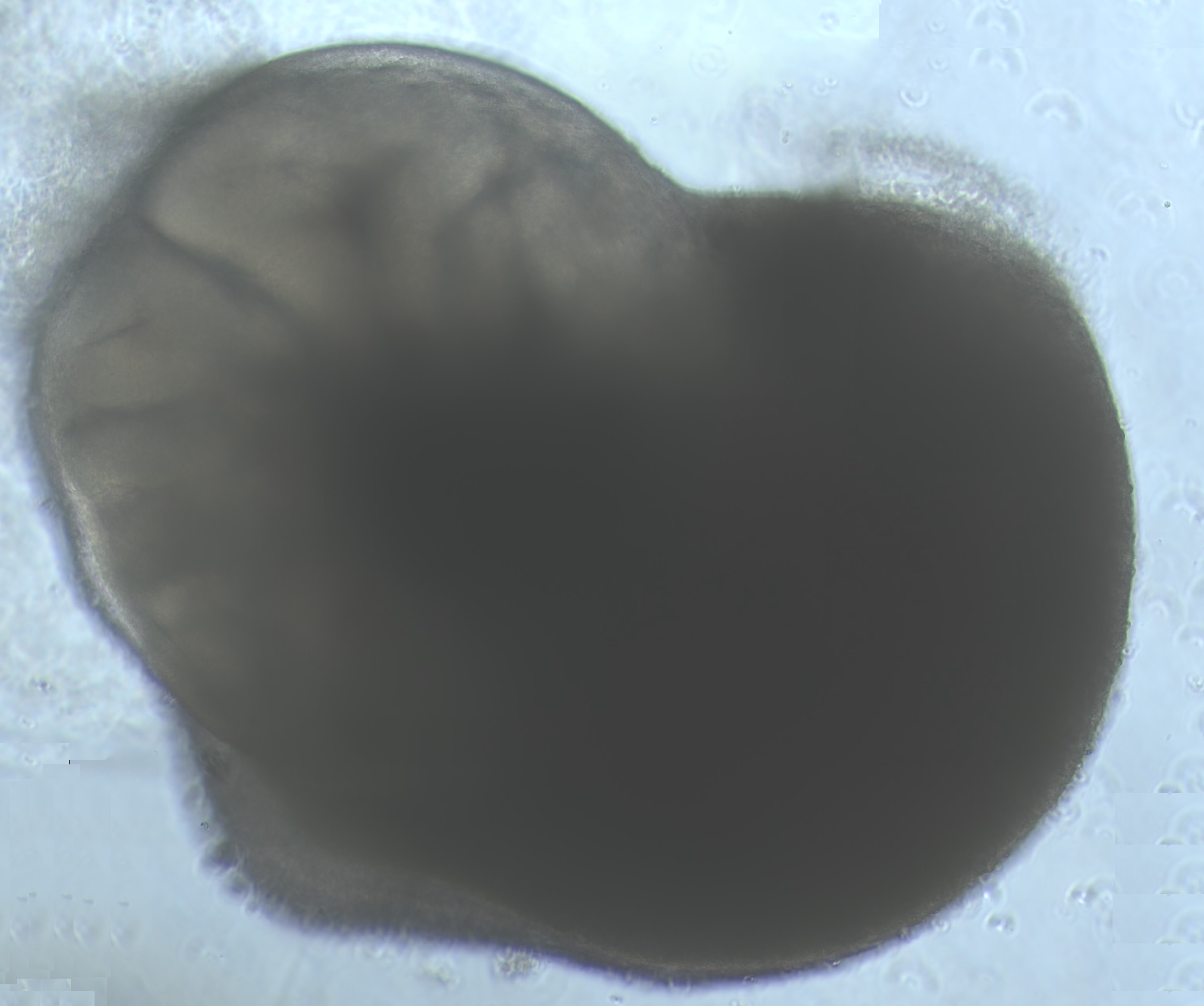 Organoide de cervell. Font: Sandra Acsota.