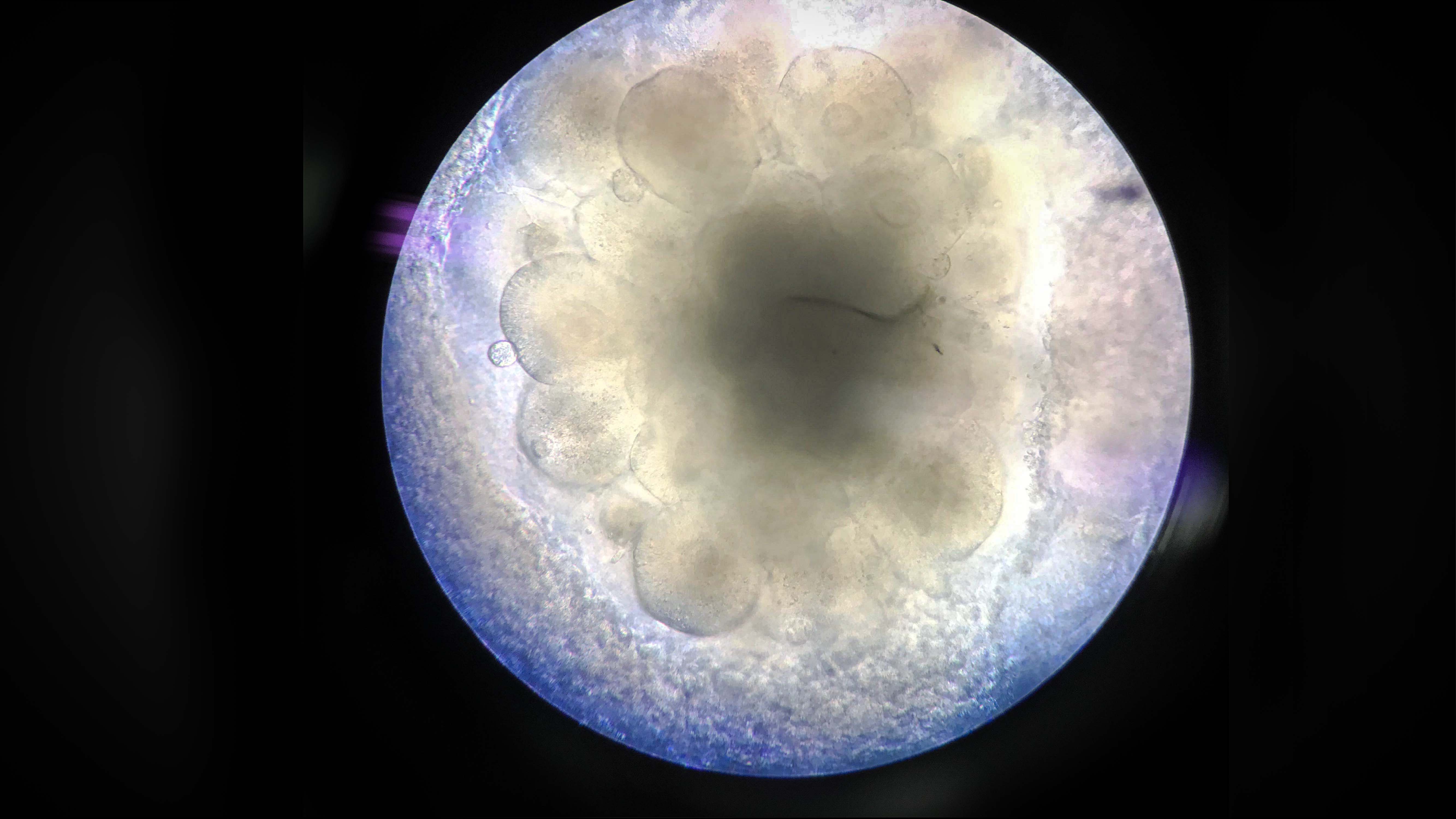 Brain organoid of human embryonic stem cells. Credit: Sandra Acosta.