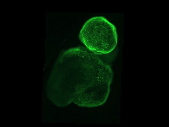 Imatge de microscopia d'organoids. Font: Sandra Acosta.